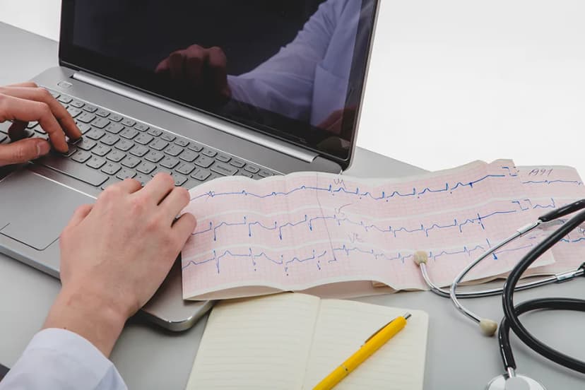 Electrocardiogram (ECG)