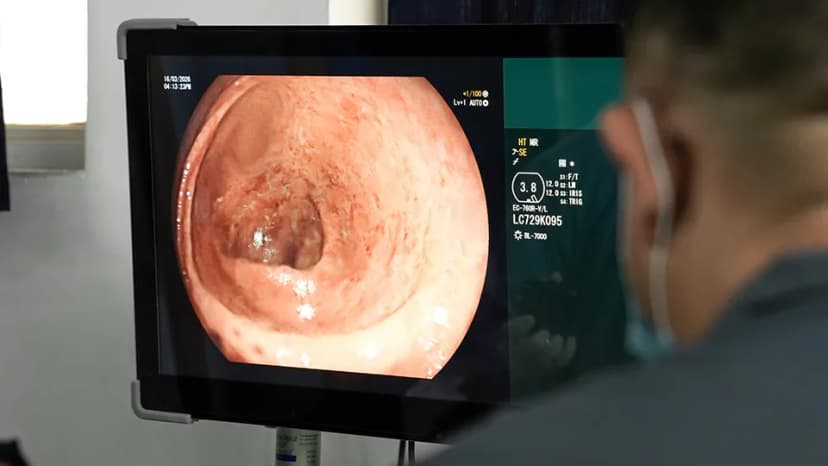 Colonoscopy