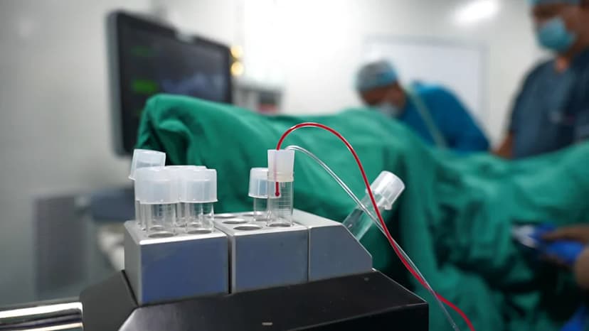 Intracytoplasmic Sperm Injection (ICSI)